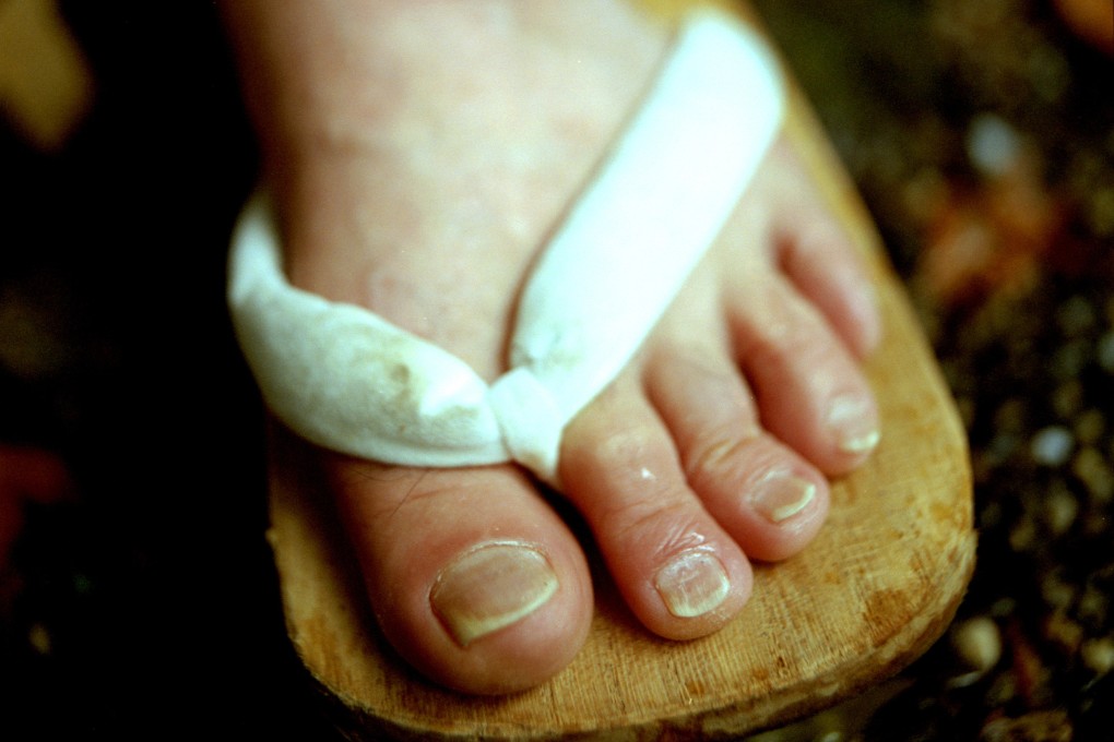 Salespeople in Zimbabwe have been wearing sandals to defy rumours they are involved in the alleged trade of human toes for witchcraft. Picture: Vera Hartmann