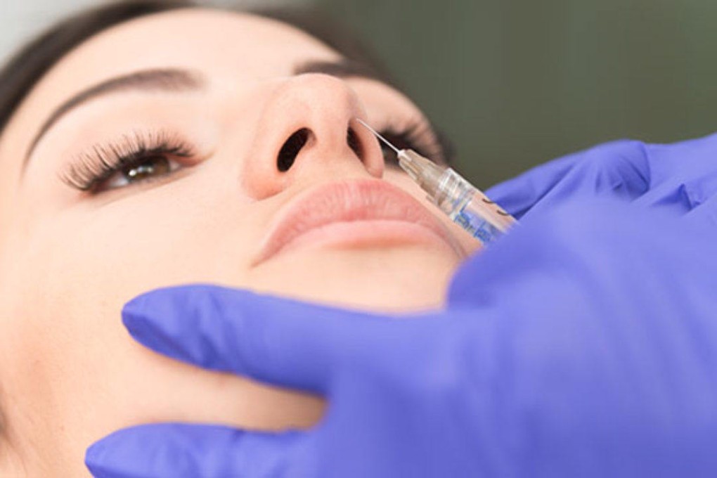 Liquid rhinoplasty changes the shape of your nose without surgery, by injecting hyaluronic acid filler in a temporary procedure.