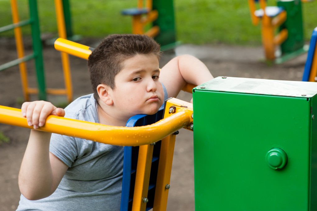 Obesity in children is a major public health challenge and it can result in a life plagued by chronic illness. Photo: Shutterstock