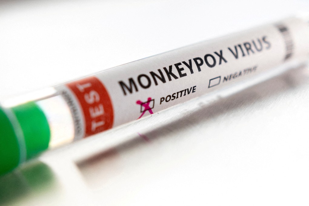 Monkeypox often lasts for two weeks to a month and can be deadly. File photo: Reuters