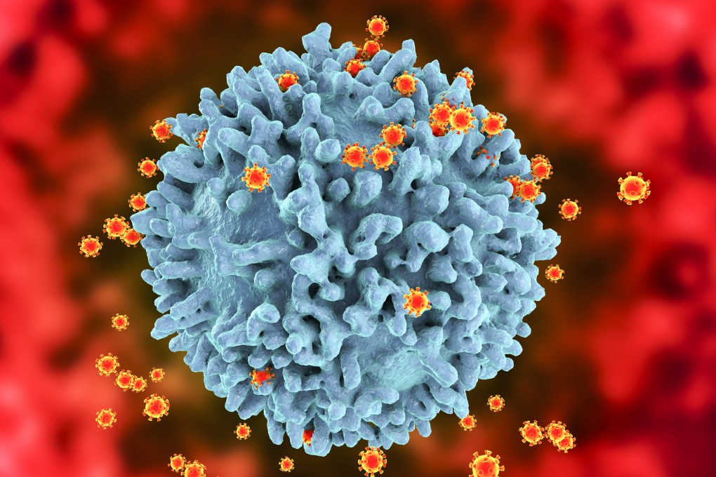 HIV viruses infecting T-lymphocytes, computer illustration. Five sex workers in Hong Kong have contracted HIV in the past 10 months.
