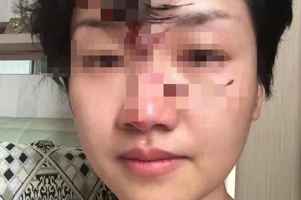 A woman said her husband abused her over 1,000 times during their marriage. Photo: Weibo
