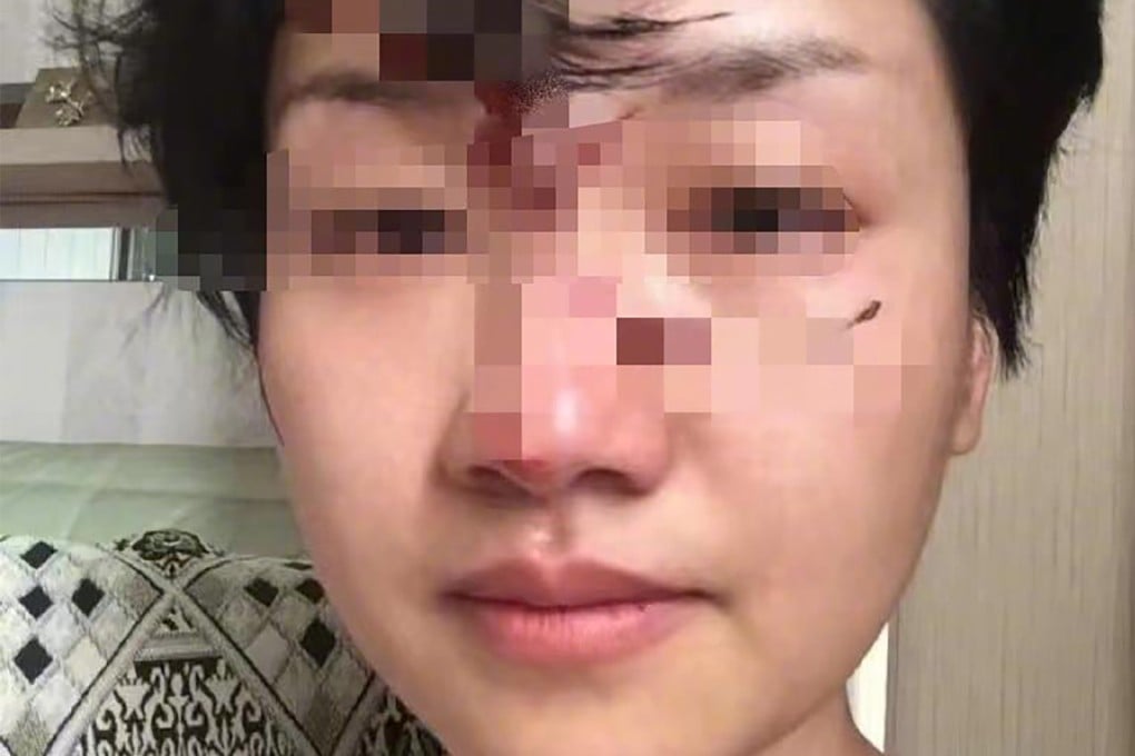 A woman said her husband abused her over 1,000 times during their marriage. Photo: Weibo