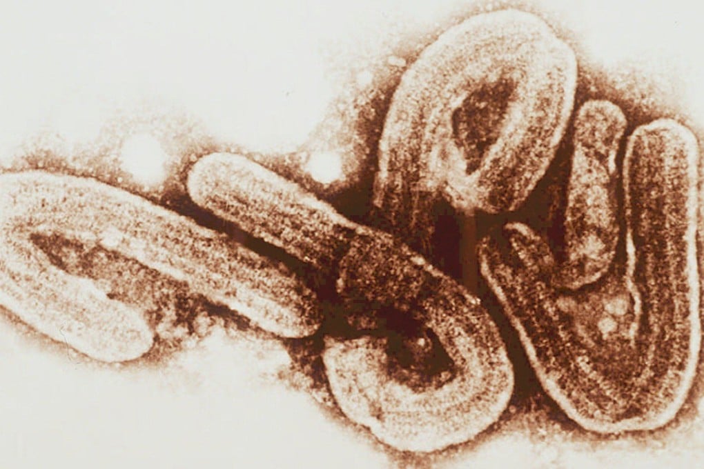 An undated microscopic view of the Marburg-Ebola virus. File Photo: AFP