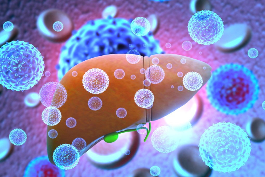 A 3D illustration shows a liver infected with hepatitis viruses. Image: Handout