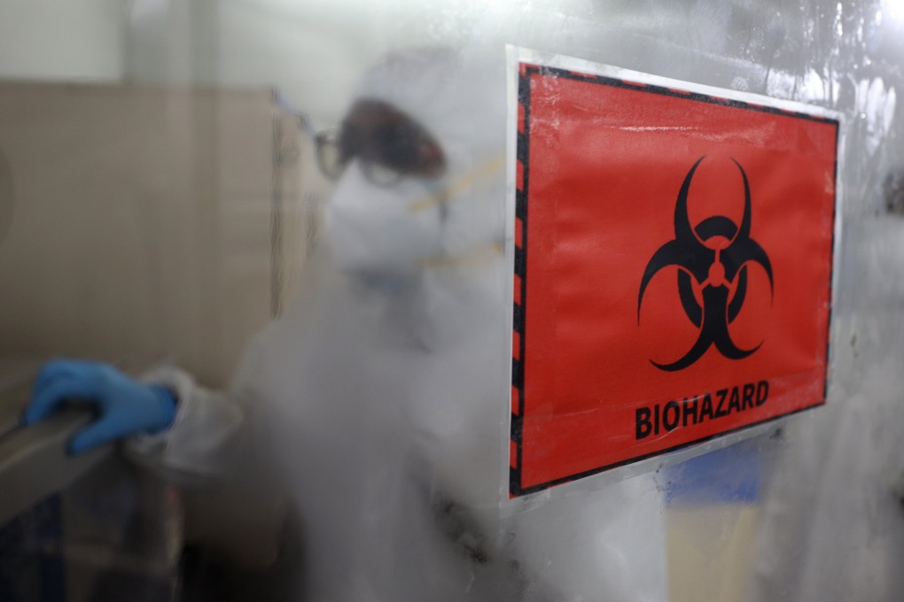 A health worker tests for the Monkeypox virus in Chennai. A man who died in India after testing positive for monkeypox in the United Arab Emirates may be Asia’s first fatality linked to the global outbreak. Photo: dpa