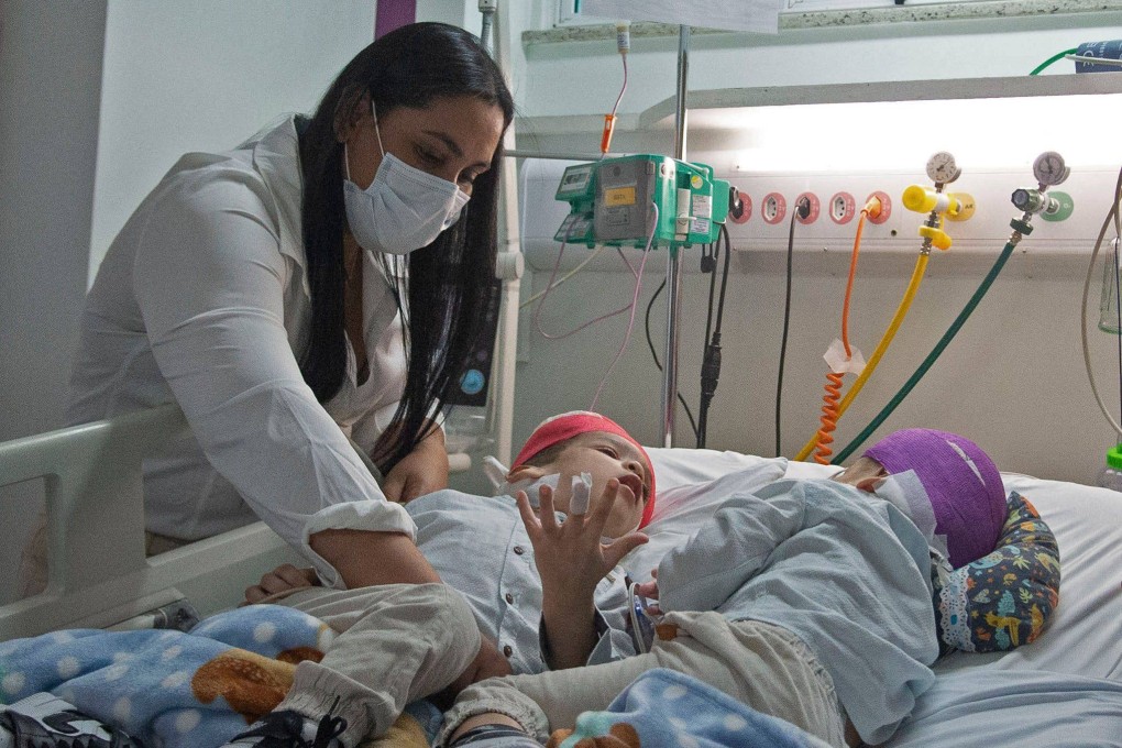 Bernardo Lima and Arthur after the twins’ operation in Rio de Janeiro, Brazil. Photo: AFP