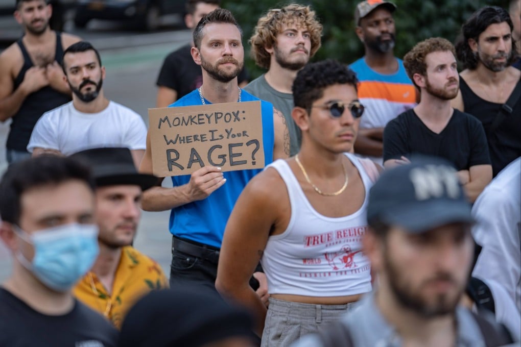 People protest during a rally calling for more government action to combat the spread of monkeypox in New York on July 21. Photo: AFP