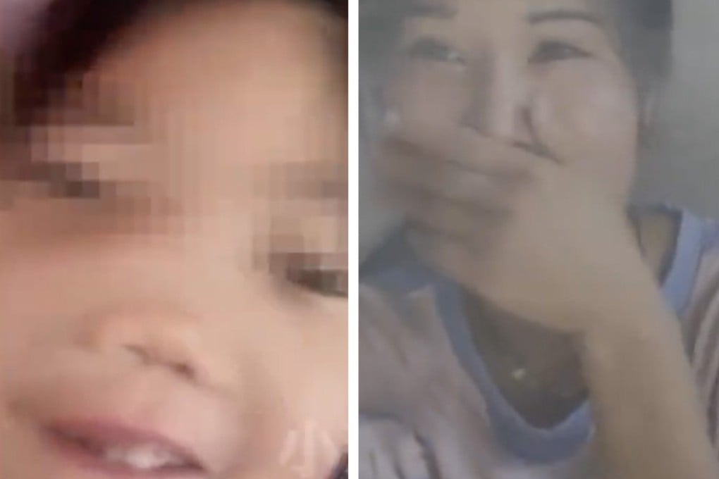 The story of a little girl who was born without a nose bridge went viral on the mainland Chinese internet this week. Photo: SCMP composite