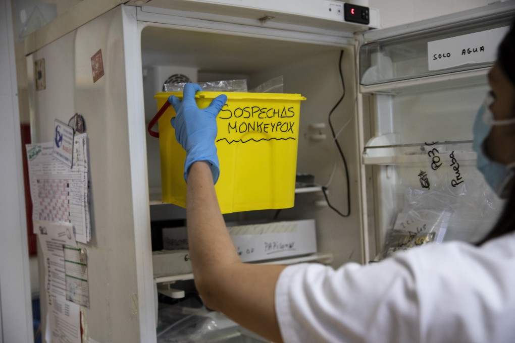 A medical laboratory technician picks up from a fridge a bucket with suspected monkeypox samples to be tested at a microbiology laboratory. Photo: Getty Images