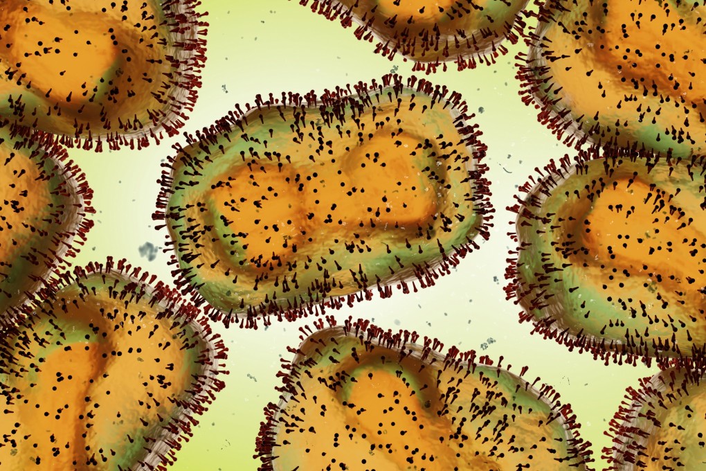 Monkeypox virus, one of the human orthopoxviruses, pathogen closeup. Photo: Shutterstock