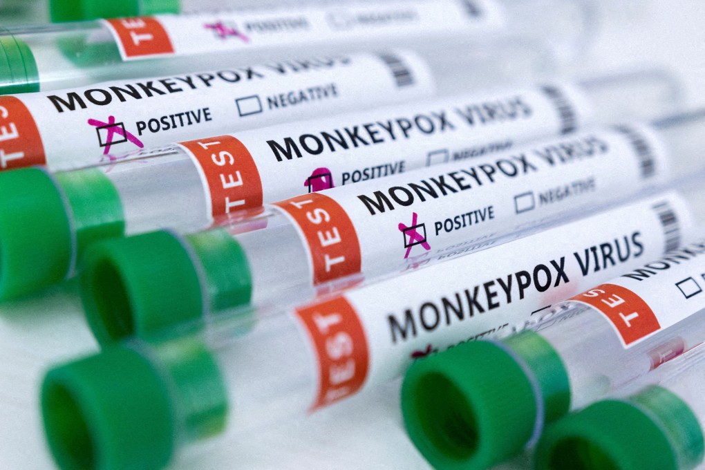 The monkeypox virus, which can cause painful sores and lesions all over the body, can be serious but is not often life-threatening. Photo illustration: Reuters