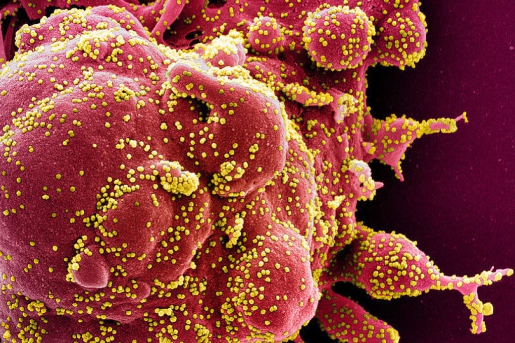 A new Omicron strain shows a striking ability to evade existing antibody treatment, scientists say. Photo: National Institute of Allergy and Infectious Diseases/AFP