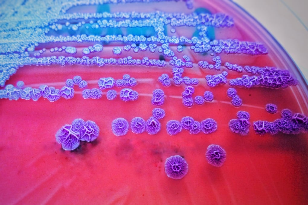 Fifteen cases of melioidosis were reported in West Kowloon between August and September this year. Photo: Shutterstock Images