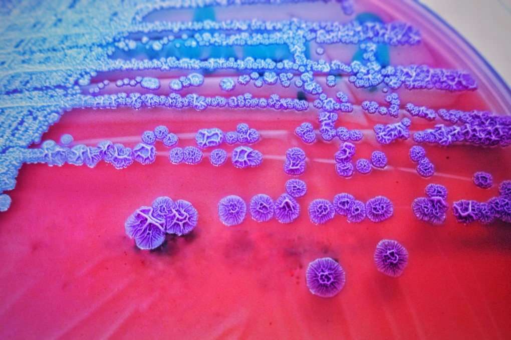 The authorities have closed their melioidosis investigation after finding Burkholderia pseudomallei bacteria in the soil above two reservoirs that serve the area where the bulk of infections were discovered. Photo: Shutterstock