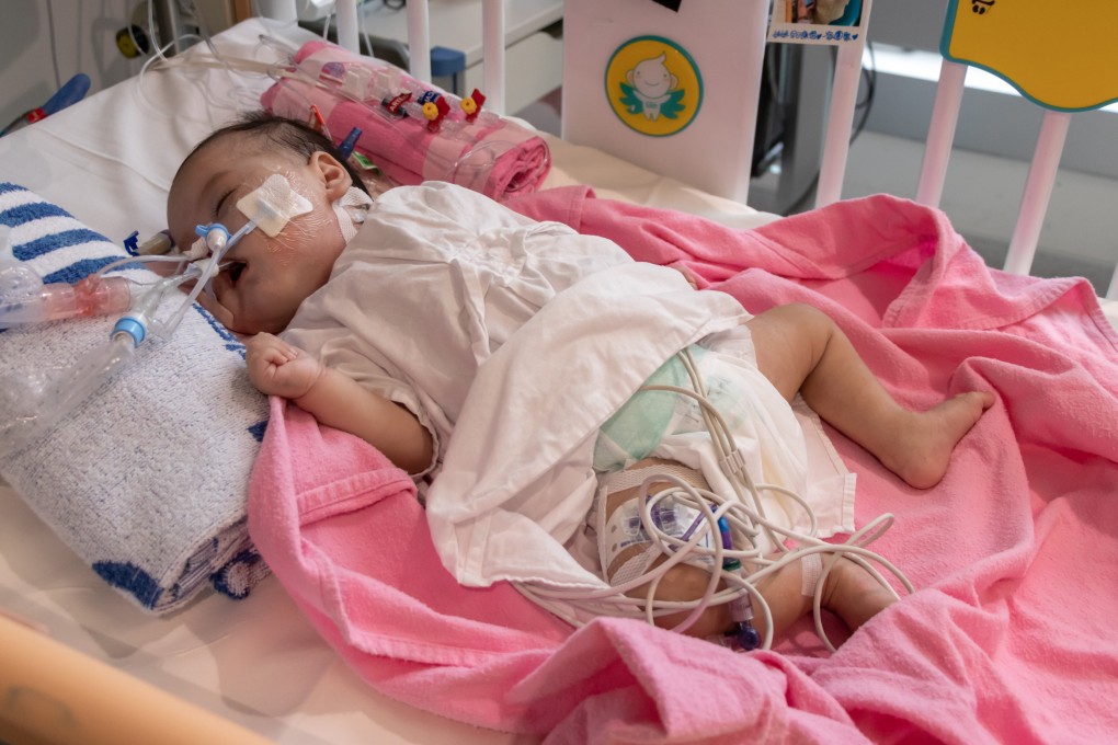 Four-month-old Cleo Lai, who needs an urgent heart transplant. Her desperate mother and medics have appealed for a donor. Photo: Hong Kong Children’s Hospital