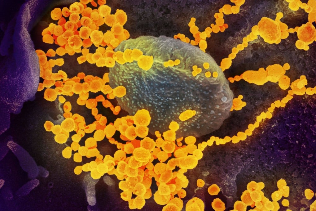 A study in Hong Kong looked at if, and how, Omicron subvariants behave differently in terms of impact on brain cells compared to earlier coronavirus strains. Image: AFP