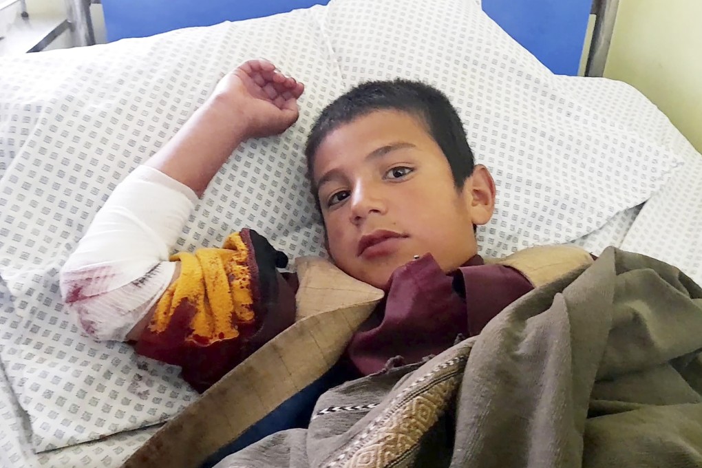 A wounded boy receives treatment at a hospital after a deadly bomb blast at a religious school in Aybak in northern Afghanistan. Photo: AP