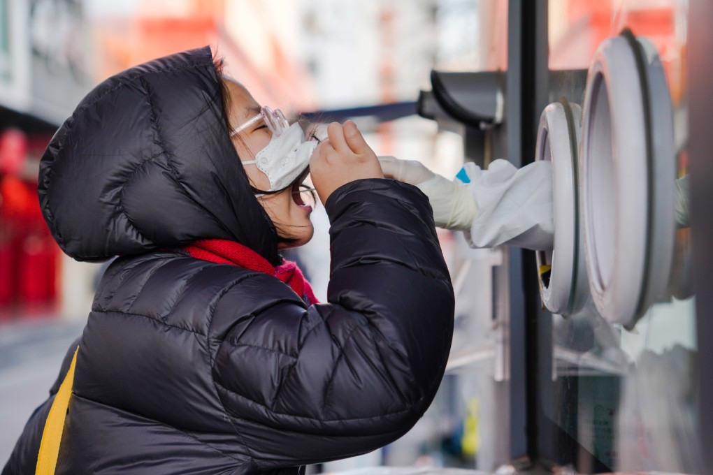 Under the new plan, PCR tests will only be required for people living and working in high-risk areas. Photo: EPA-EFE