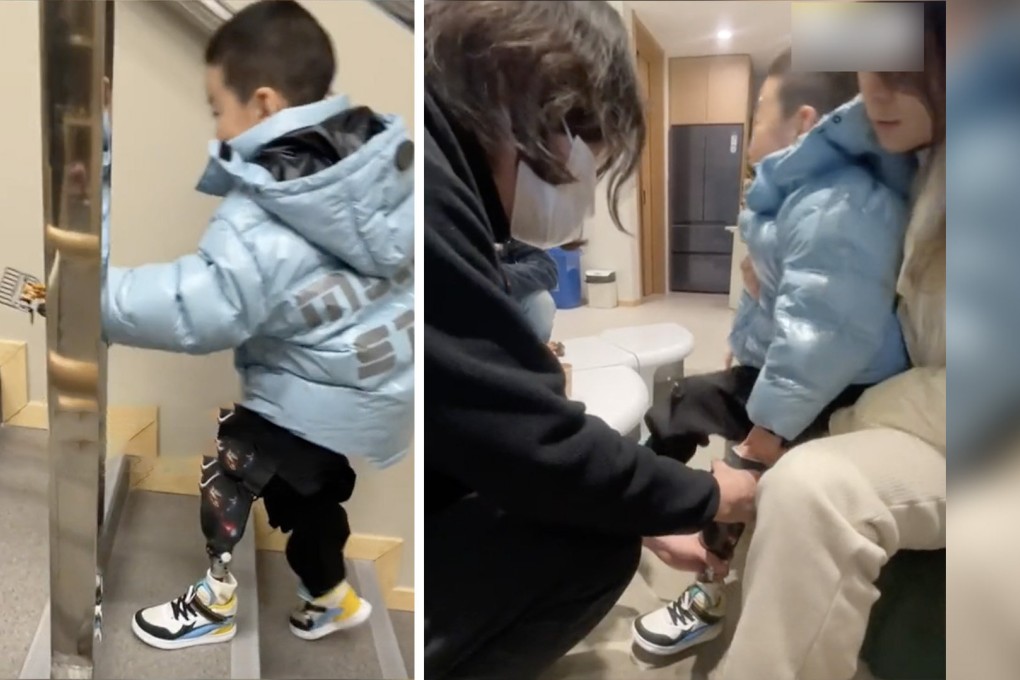 Three-year-old Wu Yicheng was overcome with joy when he was fitted with a custom-built prosthetic limb emblazoned with his favourite Marvel comics character, Iron Man. Photo: SCMP composite