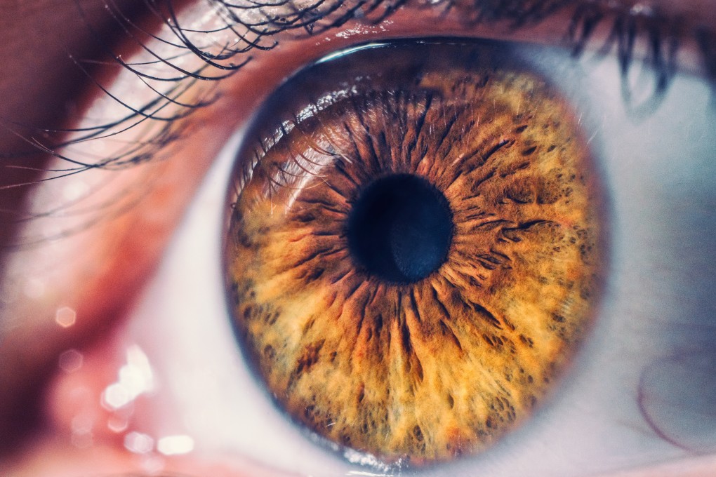 The retina is a layer of sensory cells required for clear vision. It can detach from the back of the eye for a variety of reasons. A detached retina requires prompt surgery to avoid losing sight in the eye. Photo: Shutterstock
