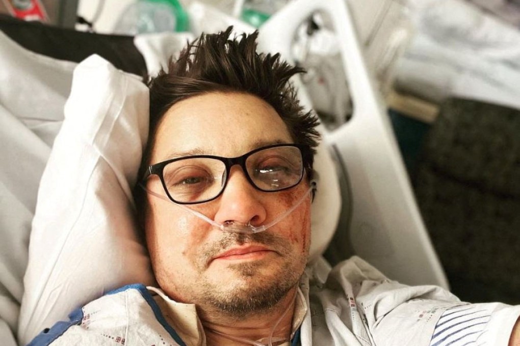 Jeremy Renner posted a selfie from his hospital bed in Nevada, showing him looking bruised with oxygen tubes in his nose. Photo: Instagram