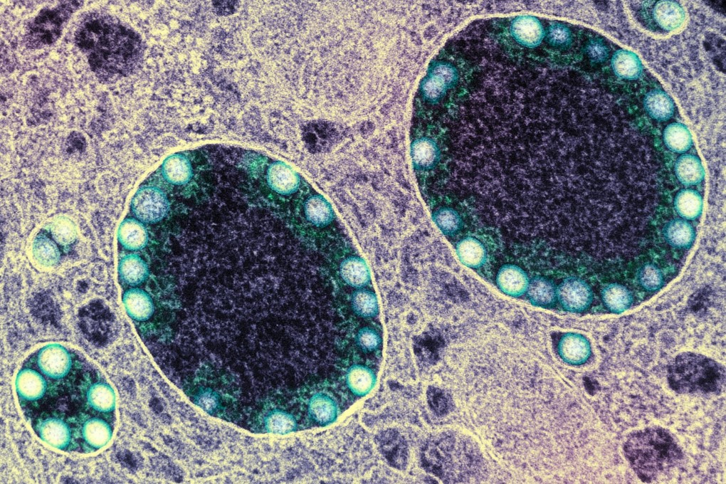 Coronavirus particles seen inside a heavily infected nasal cell. Photo: National Institute of Allergy and Infectious Diseases via Ohio State University