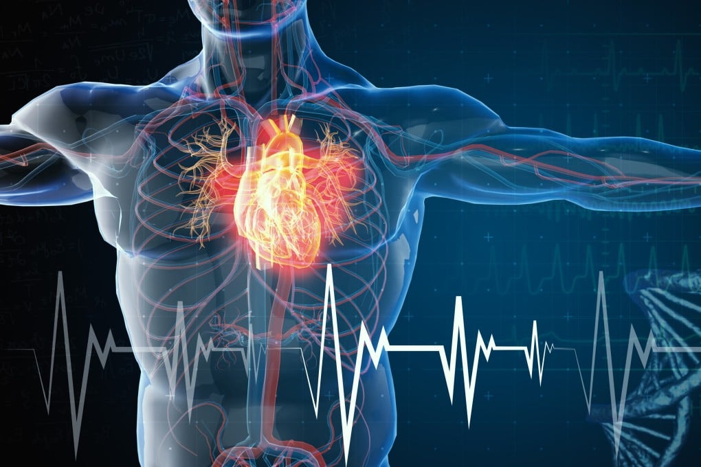One of the best ways to prevent a heart attack and maintain a healthy heart is to protect your arteries against plaque build-up and inflammation. Photo: Shutterstock