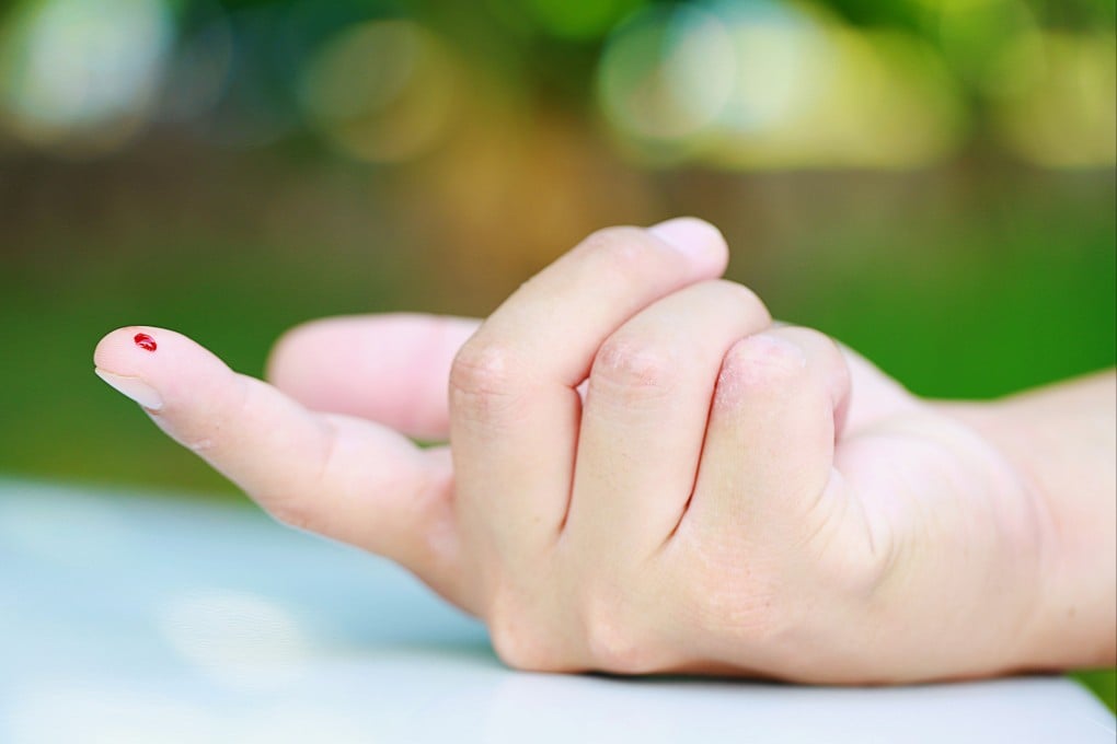 A new finger-prick blood test developed by a US geneticist could reveal much about your health – and save you from having to go to a doctor’s office to draw blood. Photo: Shutterstock