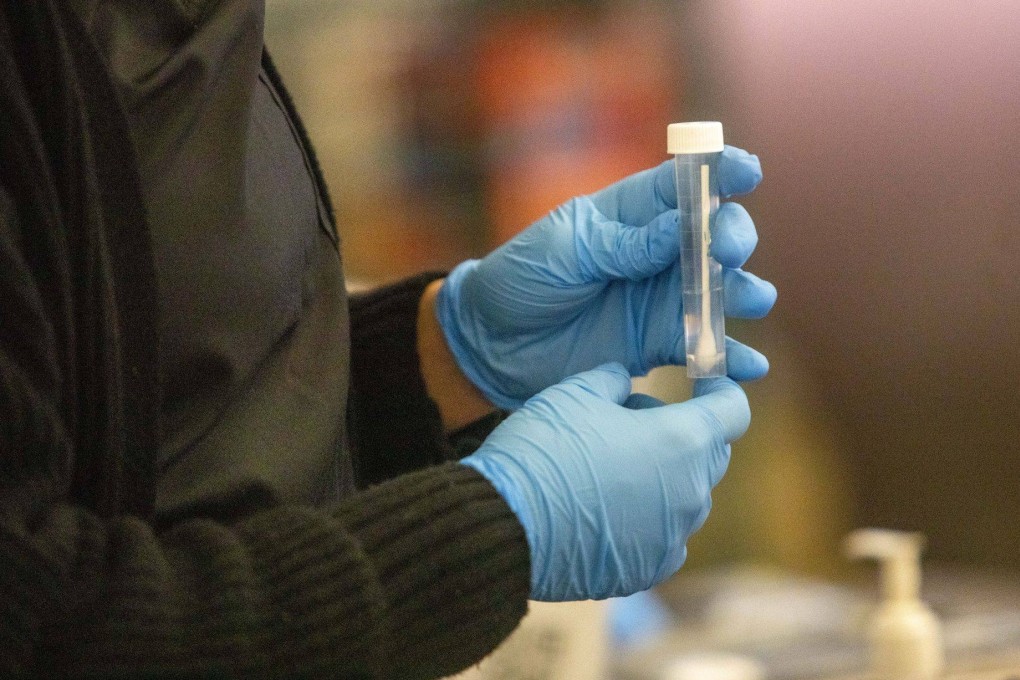A worker holds a swab at a CDC Covid-19 variant testing site at Los Angeles International Airport on January 9. Photo: Bloomberg