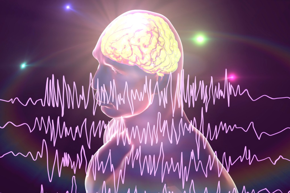 One in 10 people have at least one seizure in their lifetime. A research team in Hong Kong has found a new way to treat one of the most common forms of epilepsy, and shown it works in mice. Photo: Shutterstock
