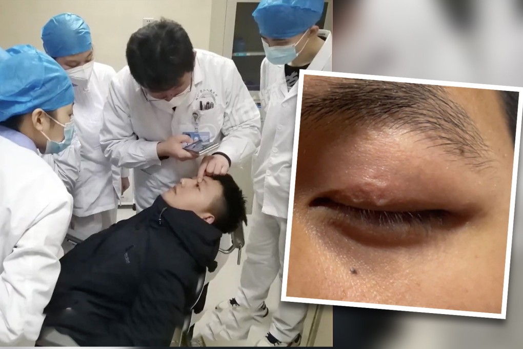 One of the doctors, with more than 40 years of professional experience, told the man that parasites like to inhabit harsh environments. Photo: SCMP composite/Weibo