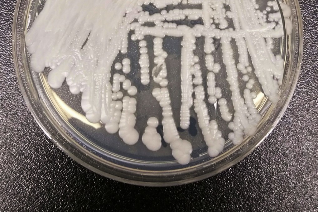 A strain of Candida auris is cultured in a petri dish at a US CDC laboratory. Photo: US Centres for Disease Control and Prevention via AP