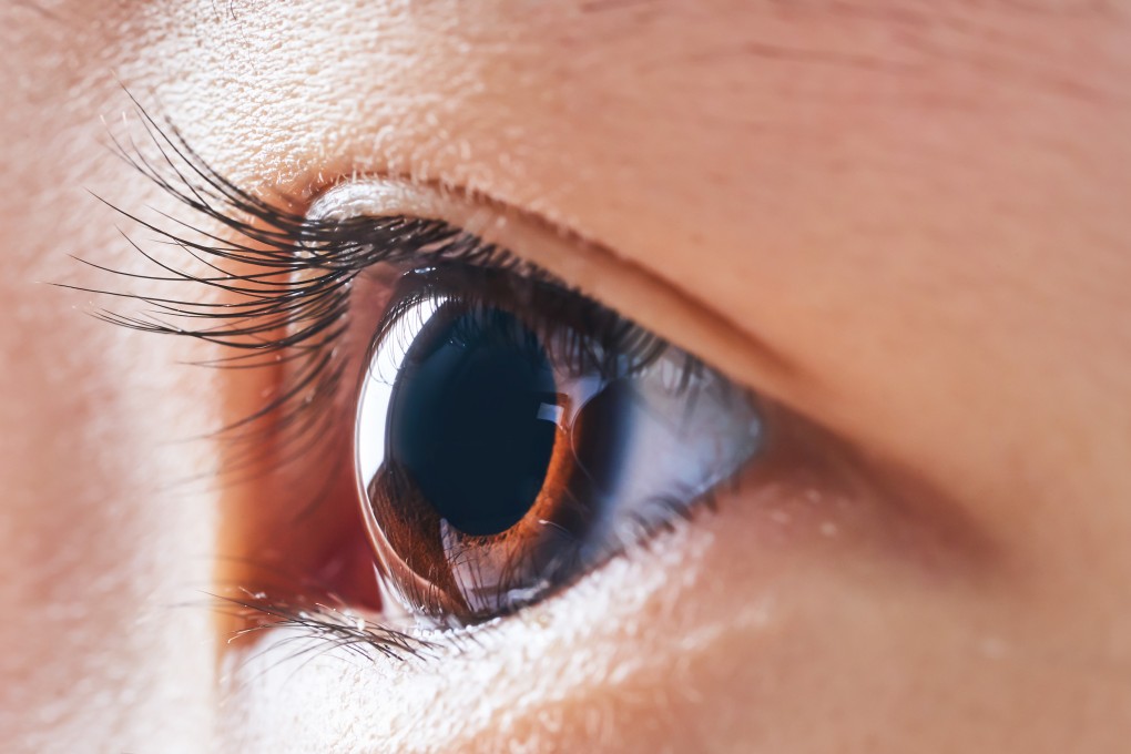 A Guangzhou-based biotech firm says it has modified a widely used US design to develop artificial corneas more suited to Asian eyes. Photo: Shutterstock