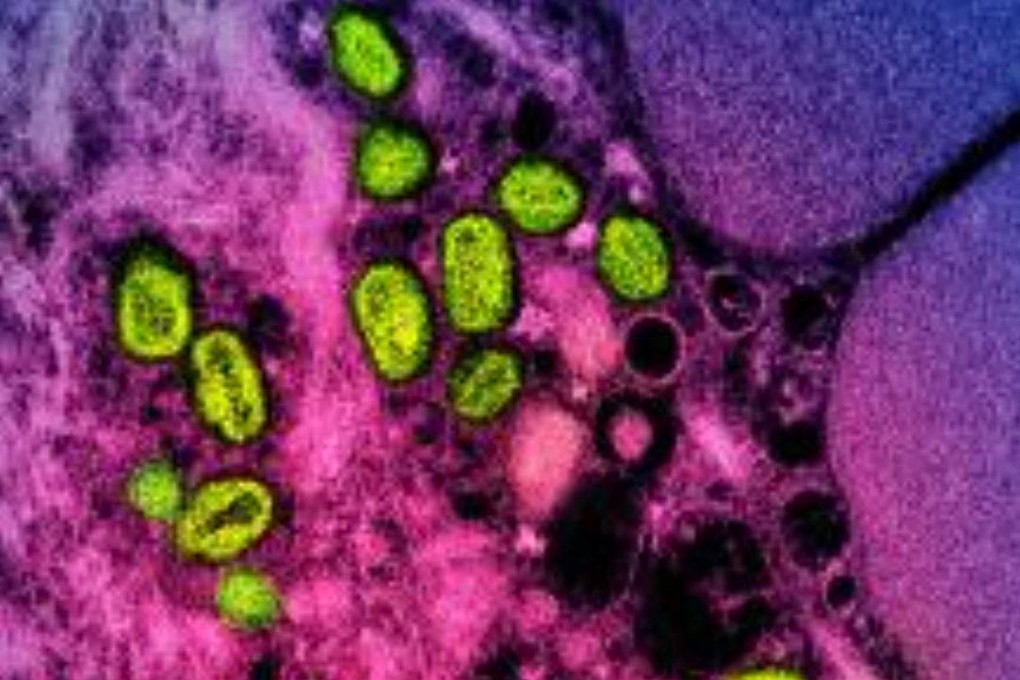 Hong Kong authorities have confirmed the third case of monkeypox in the city. Photo: AFP