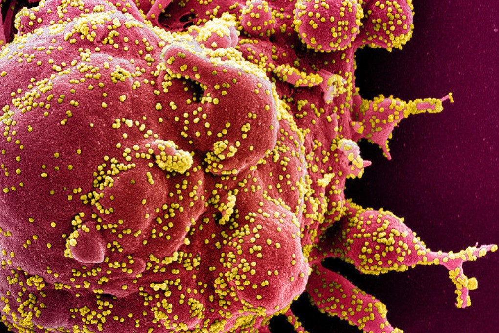 The GISAID database has been used to inform decisions about when and how to update vaccines and treatments for Covid-19 and the flu. Photo: National Institute of Allergy and Infectious Diseases/AFP