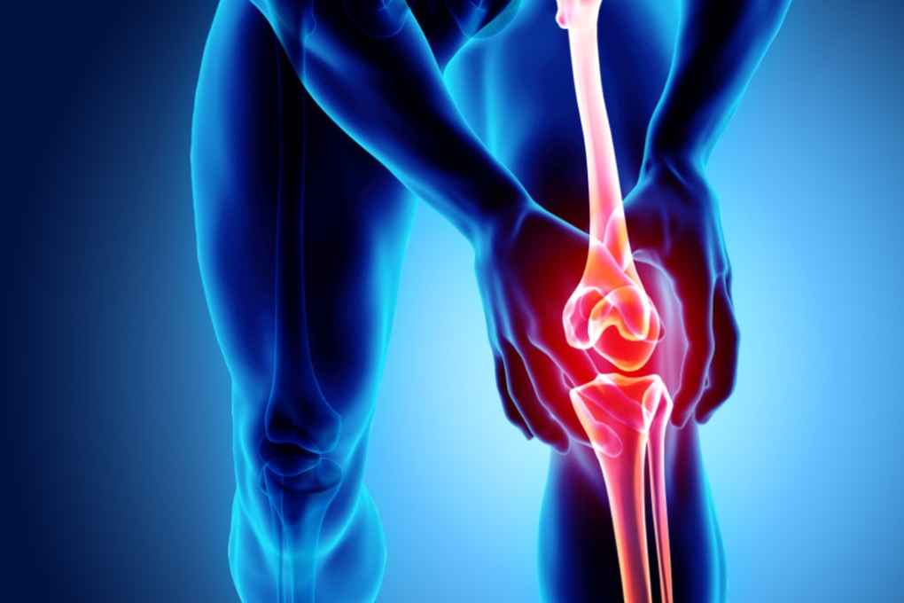 Patellar tendinopathy is a breakdown of the cells in the knee tendon. Photo: Shutterstock