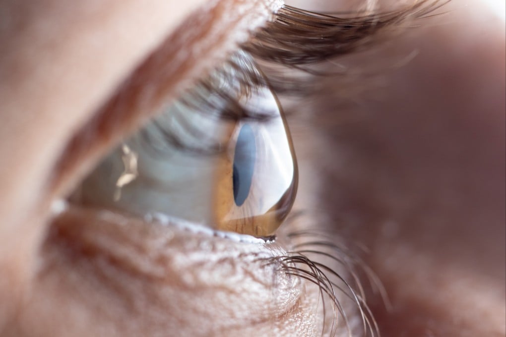Researchers have found children in Hong Kong have the highest incidence of astigmatism, which causes blurred vision, in the world. Photo: Shutterstock