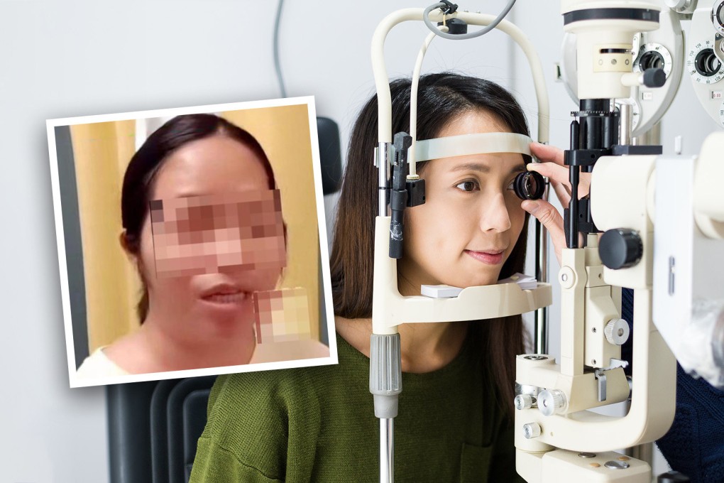‘You still have one eye’: fury as partially blind Chinese woman told ...