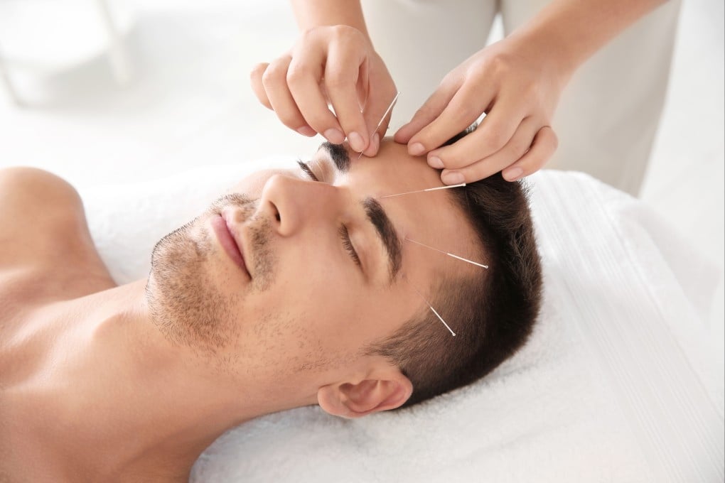 Trying to quit smoking? Traditional Chinese medicine can help you give up through therapies such as acupuncture combined with counselling. Photo:
Shutterstock