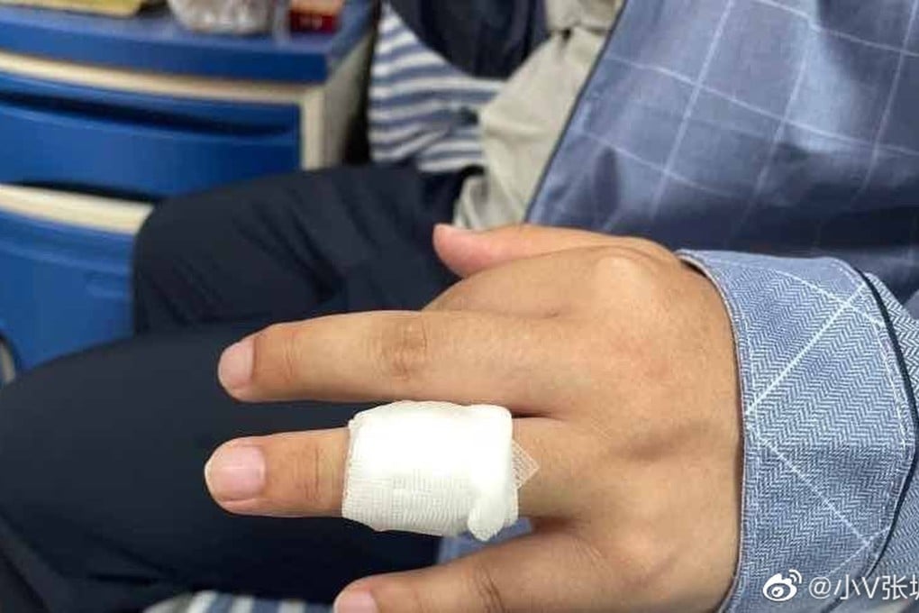Images shared by a reporter who was attacked by police in China has attracted millions of views on social media. Photo: Weibo