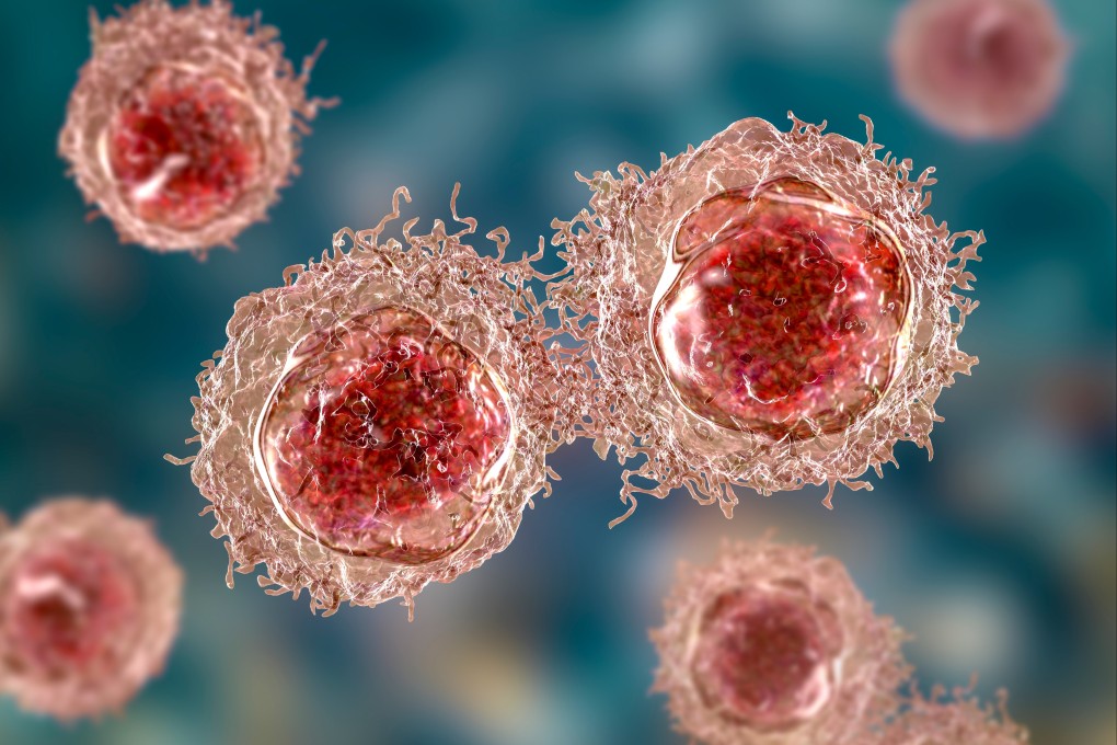 Researchers from Donghua University in Shanghai say they have a therapy that attacks tumours by combining  strategies and simultaneously inhibiting growth of the primary tumour and tumour metastasis. Image: Shutterstock