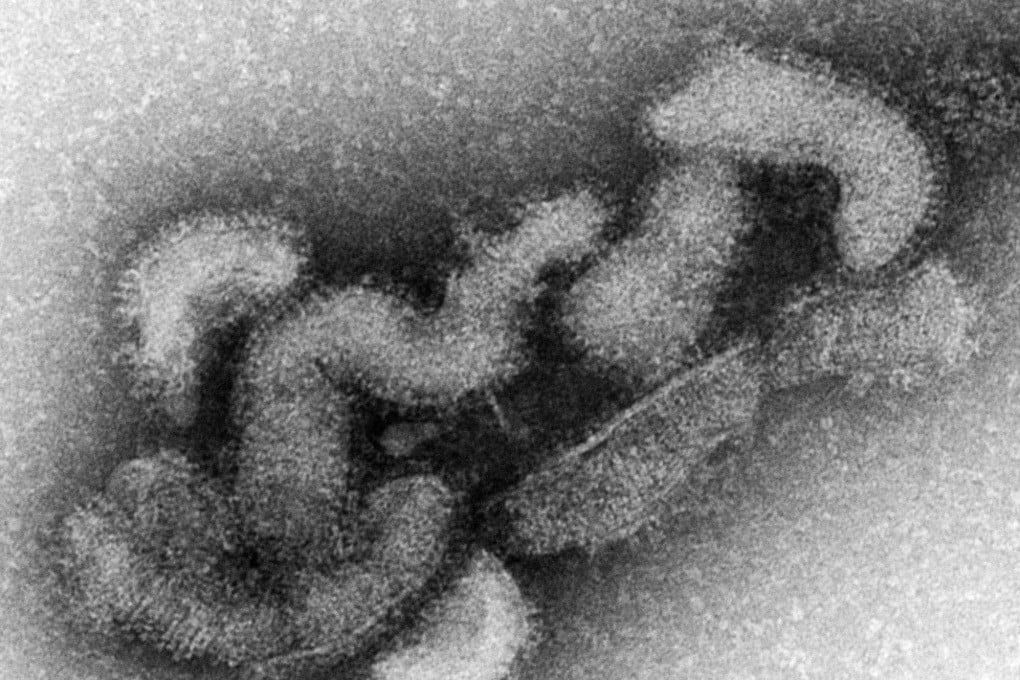 An electron micrograph of the Oz virus. Photo: EPA-EFE/National Institute of Infectious Diseases