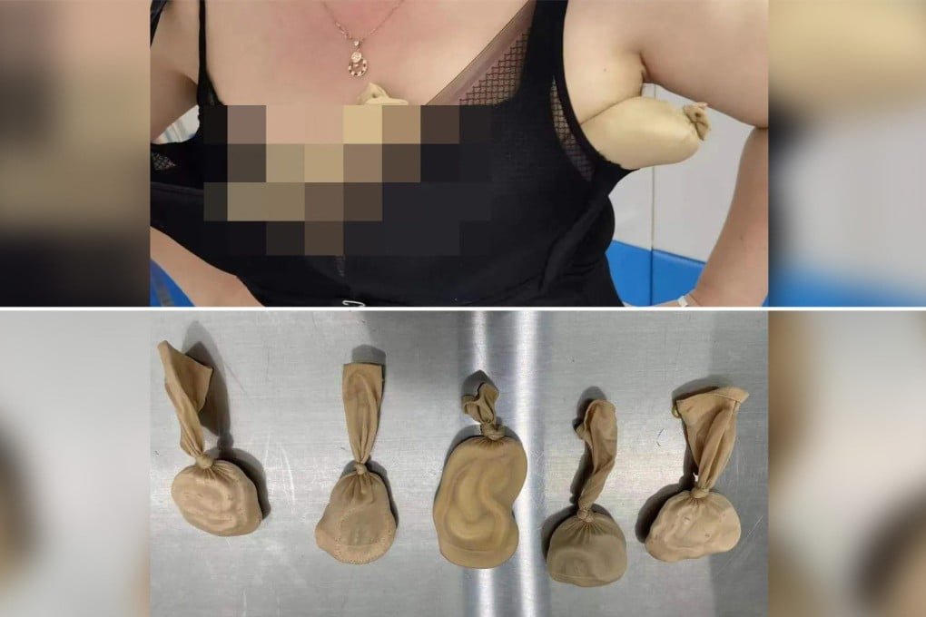 Customs officers in China were in for a slippery shock when they stopped a woman at a border-crossing point and found five live snakes stuffed inside her bra. Photo: SCMP composite/ Huanggang Customs Department