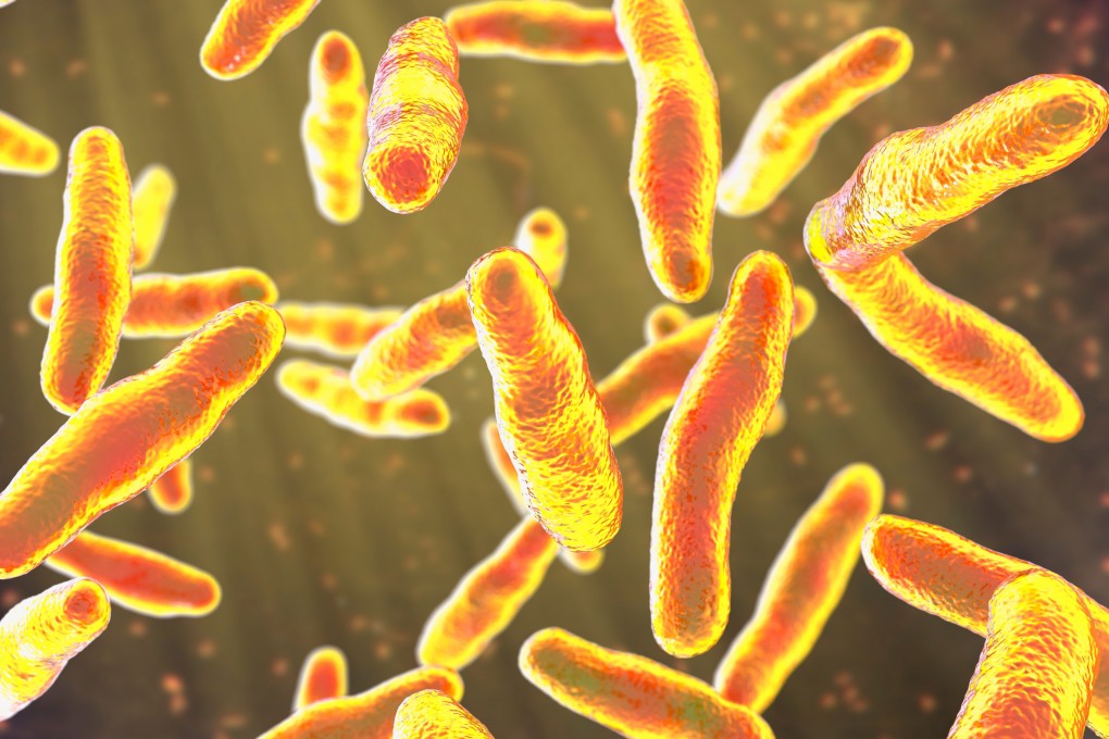 A research team from China’s Northeastern University says its smart bandage can detect and identify bacterial skin infections, as well as provide appropriate treatment. Photo: Shutterstock