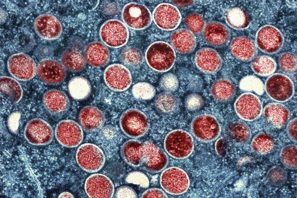 Hong Kong will open a dedicated vaccination centre to combat mpox. Photo: AP