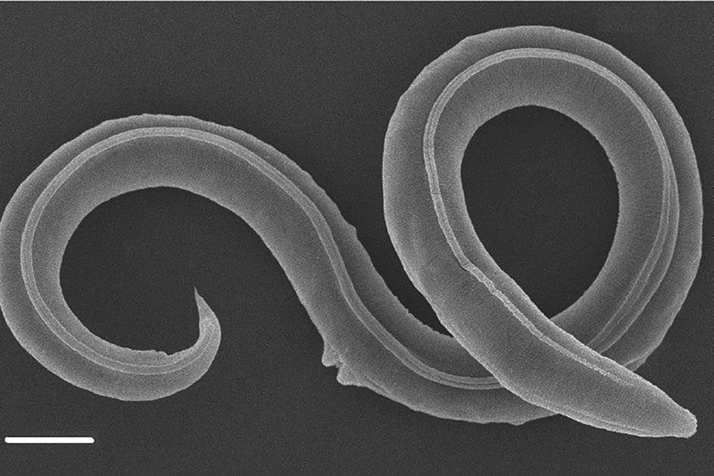 A scanning electron microscope image of a female Panagrolaimus kolymaensis. Image: Shatlilovich et al./PLOS Genetics, CC-BY 4.0
