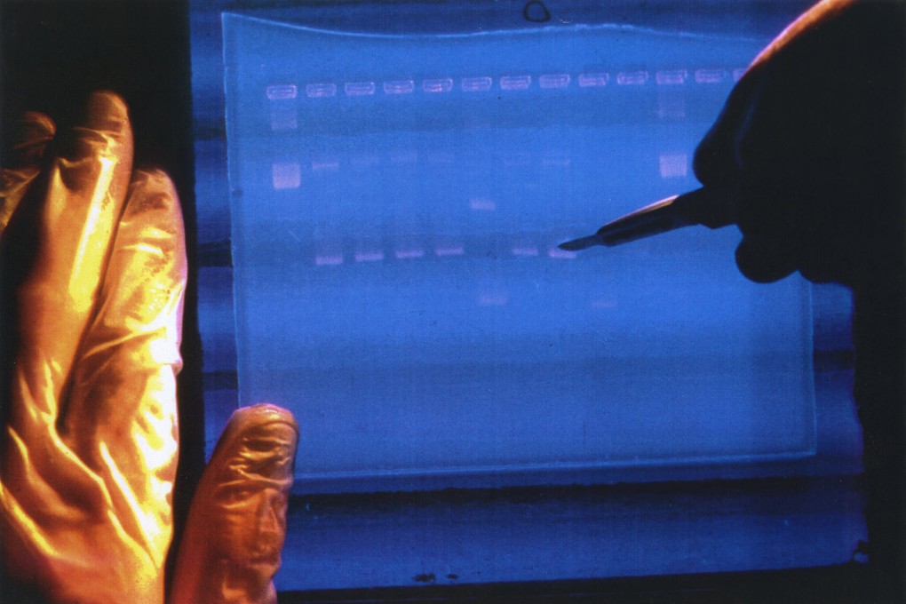 In this undated image made available by the National Human Genome Research Institute, a researcher examines the output from a DNA sequencer. Photo: NHGRI via AP