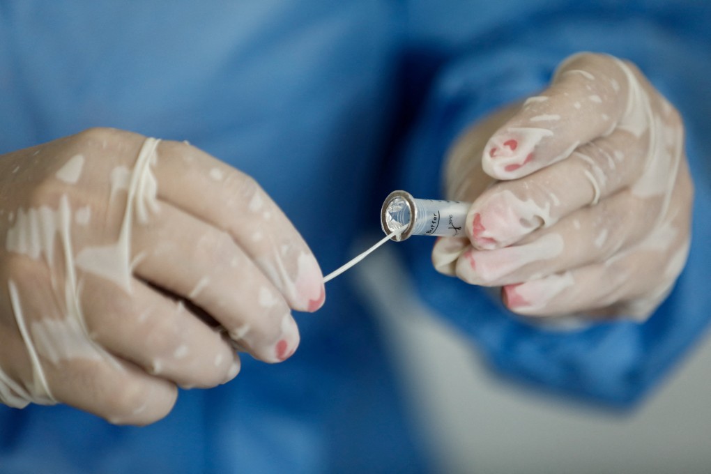 A health worker prepares a test for Covid-19. Photo: Reuters