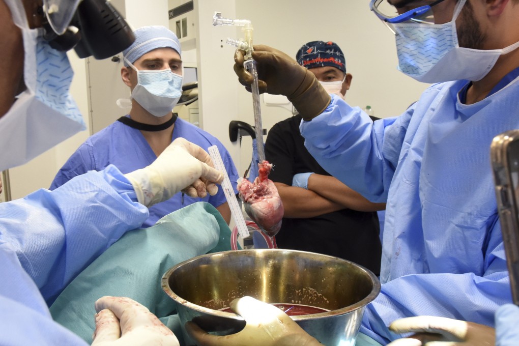 Surgeons prepare for a pig heart transplant into patient Lawrence Faucette in Baltimore, Maryland, in September. Photo: University of Maryland School of Medicine via AP